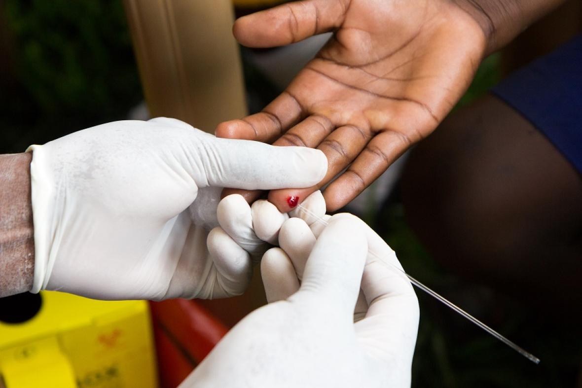 Una persona durante la toma de muestra para una prueba de VIH.