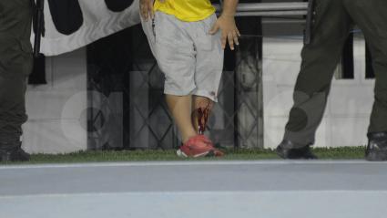 Aspecto de la herida de uno de los enfrentados durante el cotejo en el estadio Metropolitano. 
